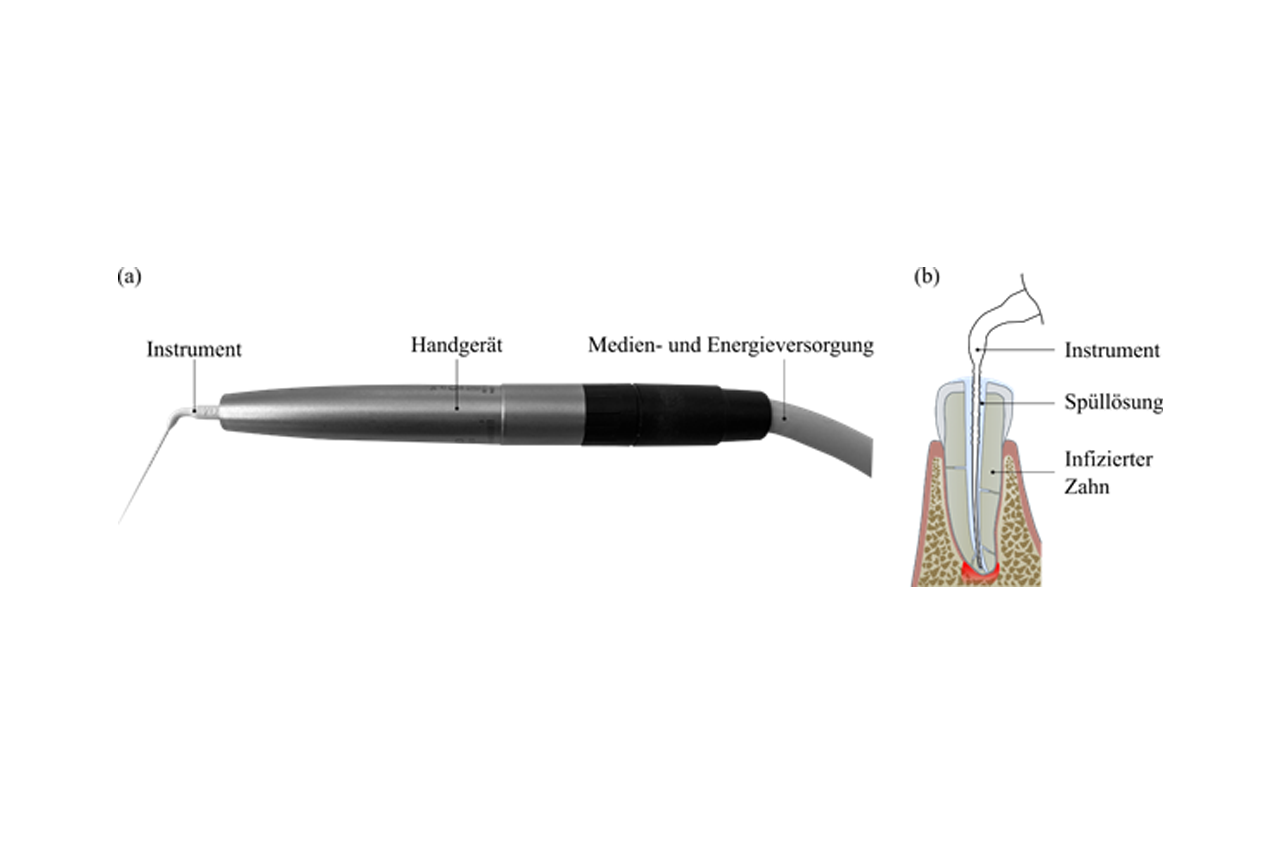 Forschungsgrafik endodontisches Instrument