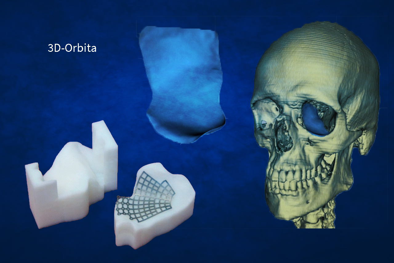 Model of a human skull and parts of the jaw